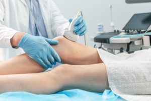 膝のエコー検査を行う様子